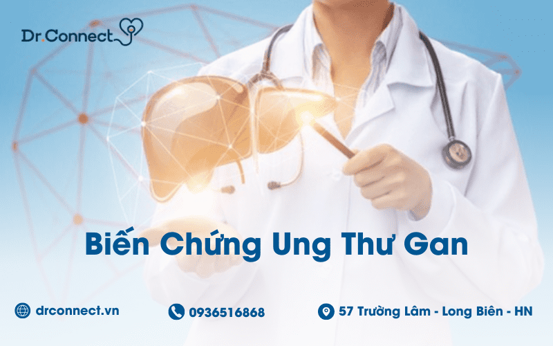 bien-chung-ung-thu-gan
