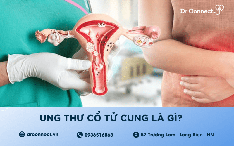 ung-thu-co-tu-cung