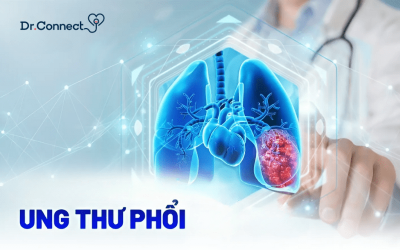 ung-thu-phoi-co-chua-duoc-khong